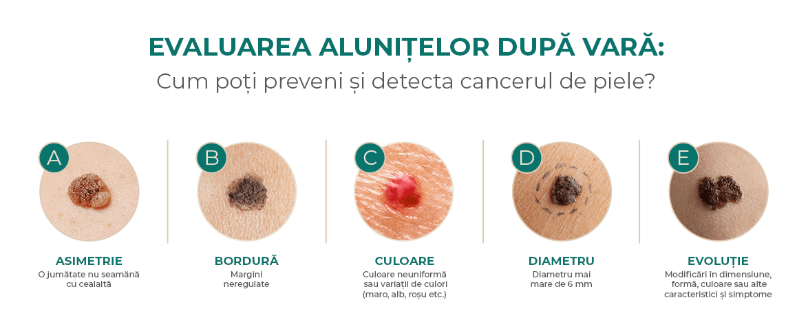 evaluare alunite
